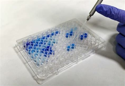 anti vegf elisa kit|vegf elisa kit r&d systems.